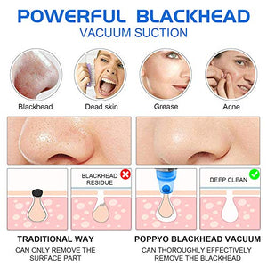 Blackhead Remover Pore Vacuum - Electric Blackhead Vacuum Cleaner Blackhead Extractor Tool Device Comedo Removal Suction Beauty Device for Women