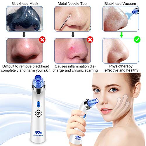 Blackhead Remover Pore Vacuum - Electric Blackhead Vacuum Cleaner Blackhead Extractor Tool Device Comedo Removal Suction Beauty Device for Women